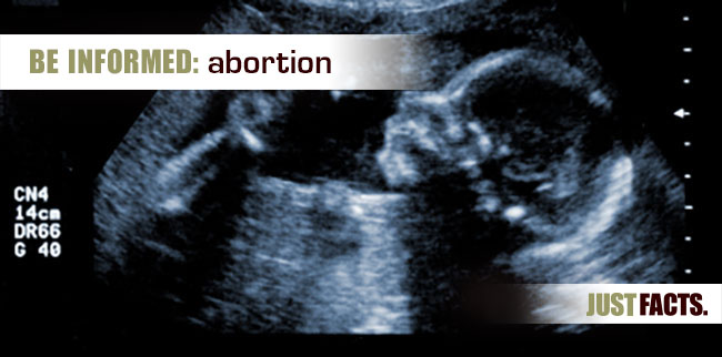 Cheap write my essay does abortion have severe psychological effects?